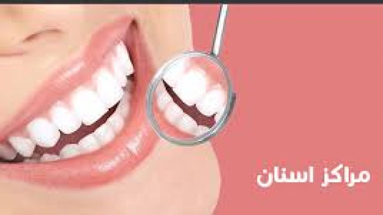 كود مطار بيشه Ficky Bunsa