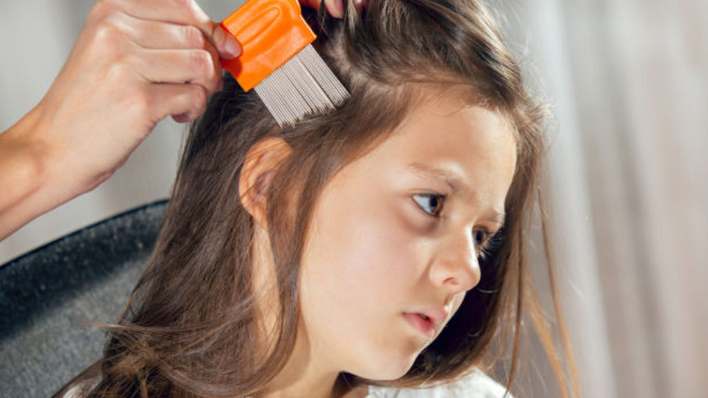 طرق علاج تقصف الشعر عند الاطفال