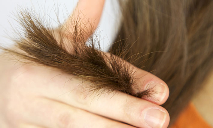 علاج تقصف الشعر طبيا
