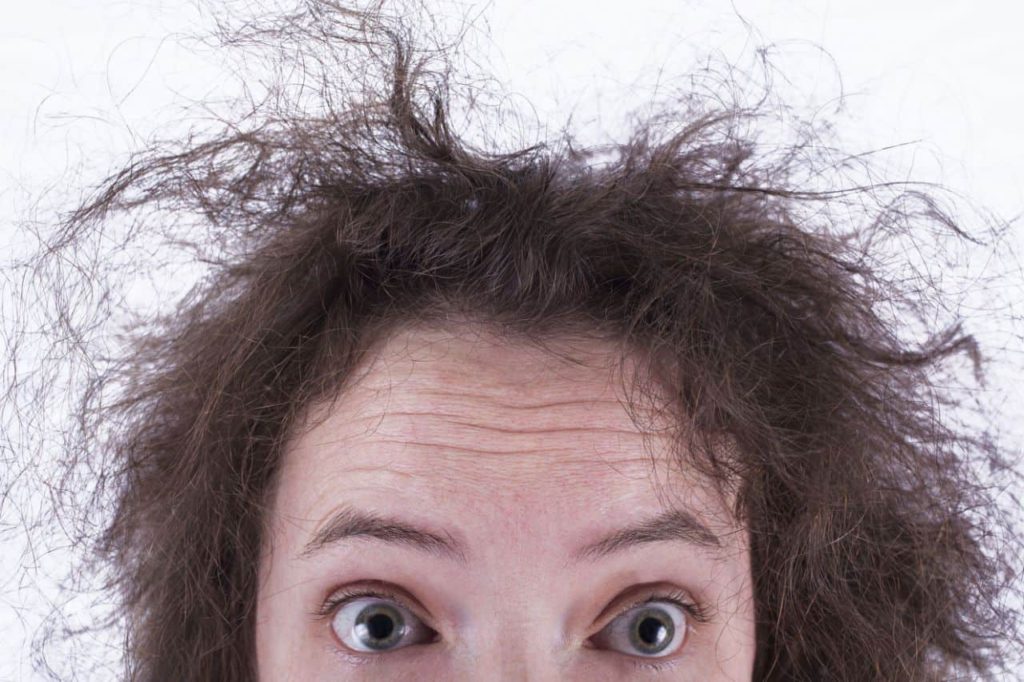 علاج تقصف الشعر من الامام