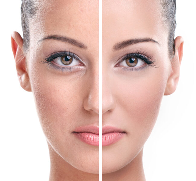 عمليات تجميل الجسم والوجه