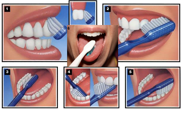 بالصور تنظيف الاسنان للاطفال