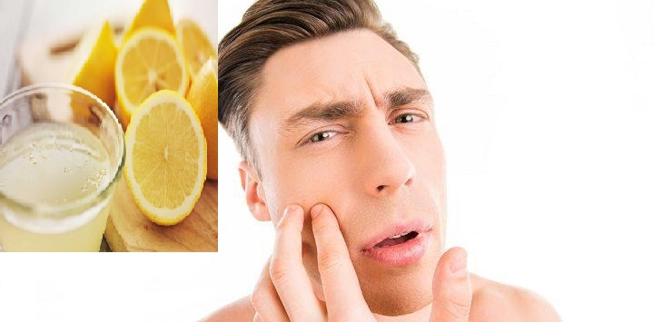  طريقة استخدام الليمون للوجه