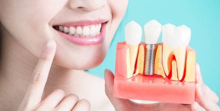 تركيبات الاسنان الزيركون