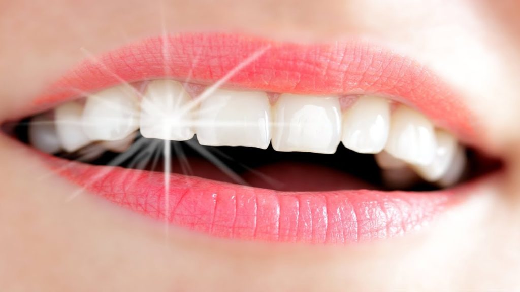 نصائح بعد عملية زرع الاسنان