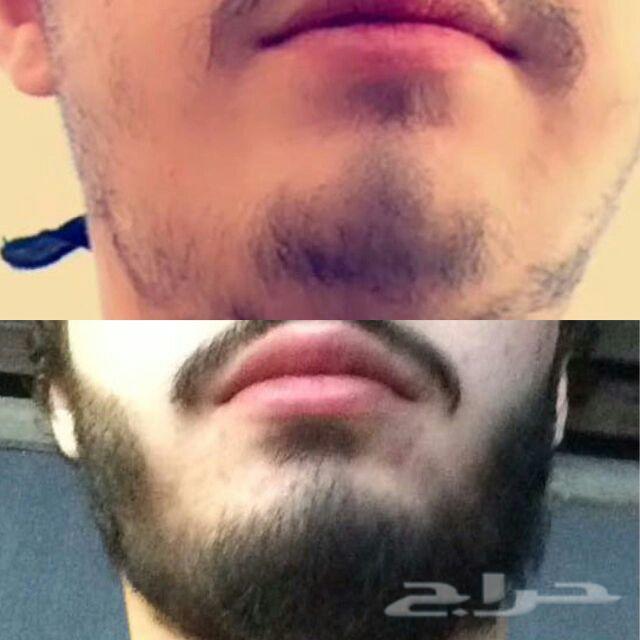 فوائد الزيت الأفغاني للرجال