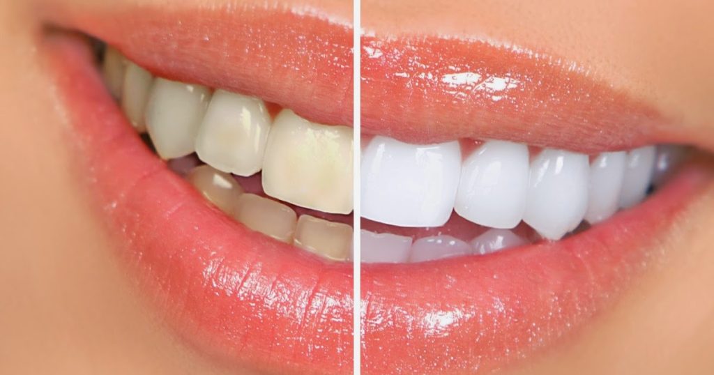  دراسة جدوى عيادة اسنان السعودية
