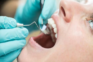 مركز طب الاسنان الاحساء